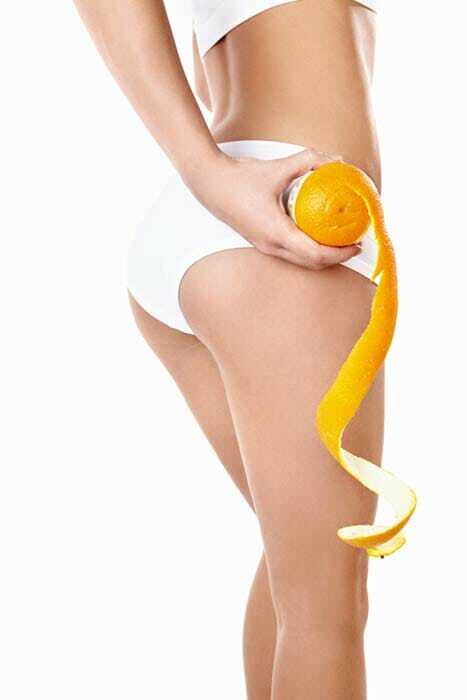 Aktiv gegen Cellulite medfit Dornbirn