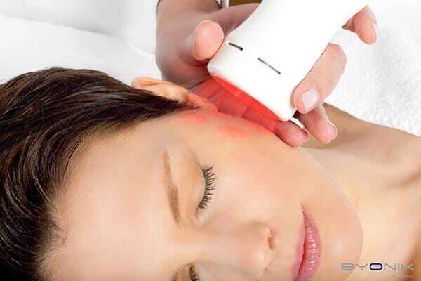 Byonik Laserbehandlung Biolifting medfit Dornbirn