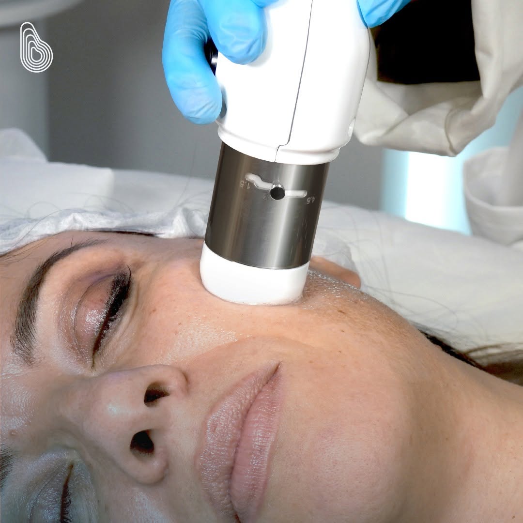 med fit Dornbirn | CFU-Elife Hifu Gesichtsbehandlung - hochfokussierter Ultraschall zur Hautstraffung und Faltenreduktion
